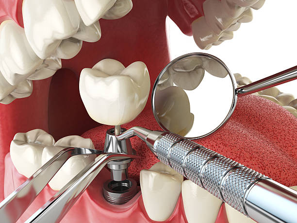 Best Emergency Dental Services for Seniors in Montgomery, WV